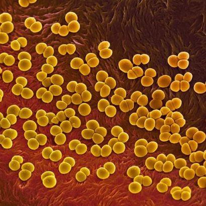 Drug resistant bacteria