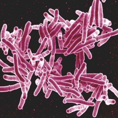 bacterial cells