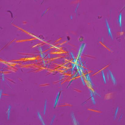 crystals