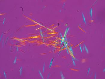 crystals